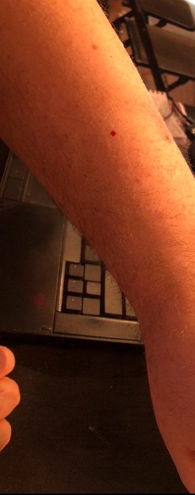 We’re about five feet from the ring apron, and DeGale’s right eye is filled with blood. One of the worst cuts I’ve ever seen. @danrafaelespn sitting next to me and he just got hit with some blood #TruaxDeGale2