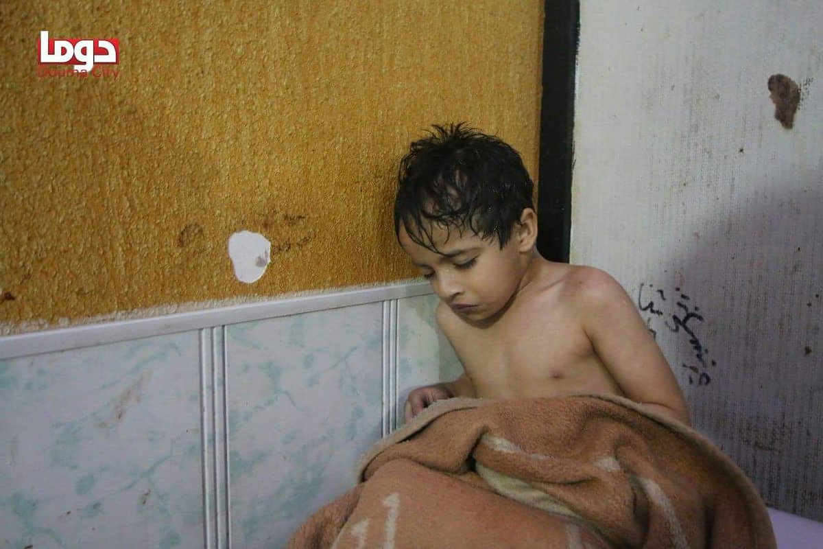 NwarAlahmad's tweet photo. إرتفاع عدد شهداء مجزرة #الكيماوي التي قامت بها عصابات الأسد بمدينة #دوما في الغوطة الشرقية إلى أكثر من 150 شهيداً وألف حالة اختناق حتى اللحظة. الصور في التعليق

#الاسد_يقصف_دوما_بالكيماوي https://t.co/FeuWsbrrAv