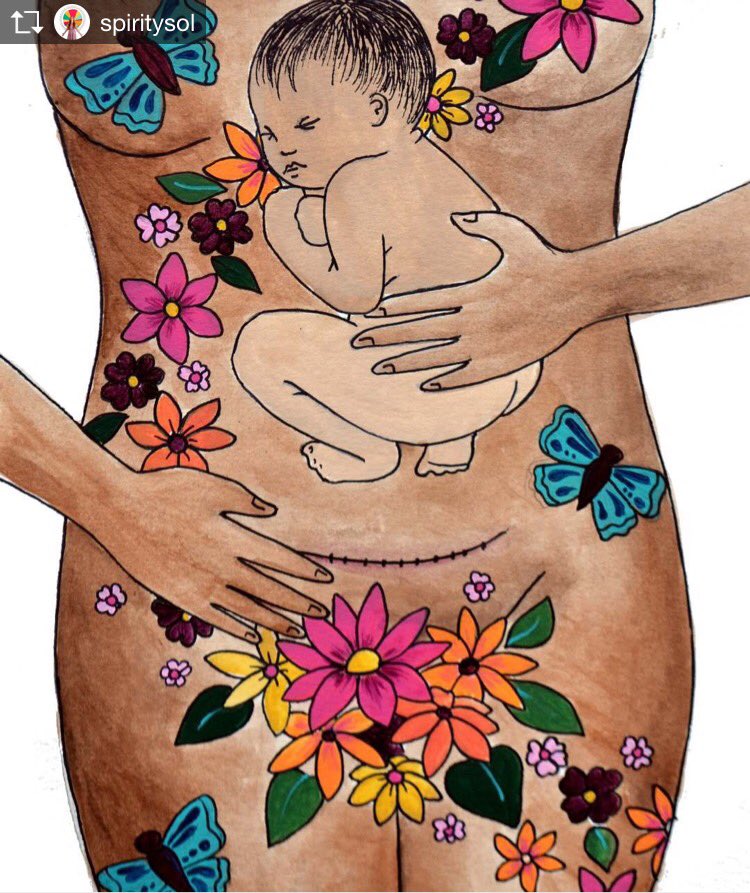 Mat_Sunshine's tweet photo. How beautiful is this?! ๐
Repost @SpiritYSol
#caesareanawarenessmonth #allbirthisbeautiful #celebratebirth #birthisbirth #birth #pregnancy #labour https://t.co/isiguM1cm3