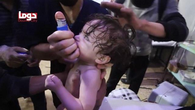 julienbahloul's tweet photo. Images intenables d'enfants gazés en #Syrie, tentant de respirer par tous les moyens, tentant de survivre. 
Mais le plus insupportable est ce silence. Pas une manifestation de masse, pas de mouvement de solidarité. https://t.co/pPkJ0aAKnp