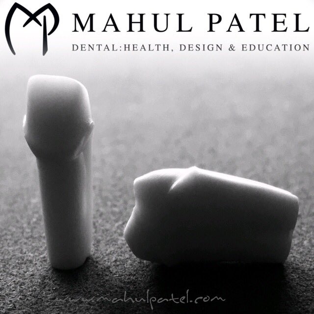 DrMahulPatel's tweet photo. Preparation for CAD restorations @King’s College London Operative Dentistry Diploma @kingsdentistry @KingsCollegeNHS #drmahulpatelrestorative #since2002 #handmade #handcrafted #madebyhand #toothbeforeself
#dentaltraining #dentaleducation #crownpreparations #preparationevolution https://t.co/P5tyunFtKj
