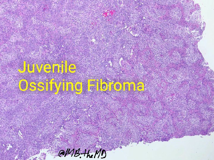 MB_thepathMD's tweet photo. #pathology #pathresident #pathologists #pathArt #pathcases https://t.co/0DzfCZXJDH