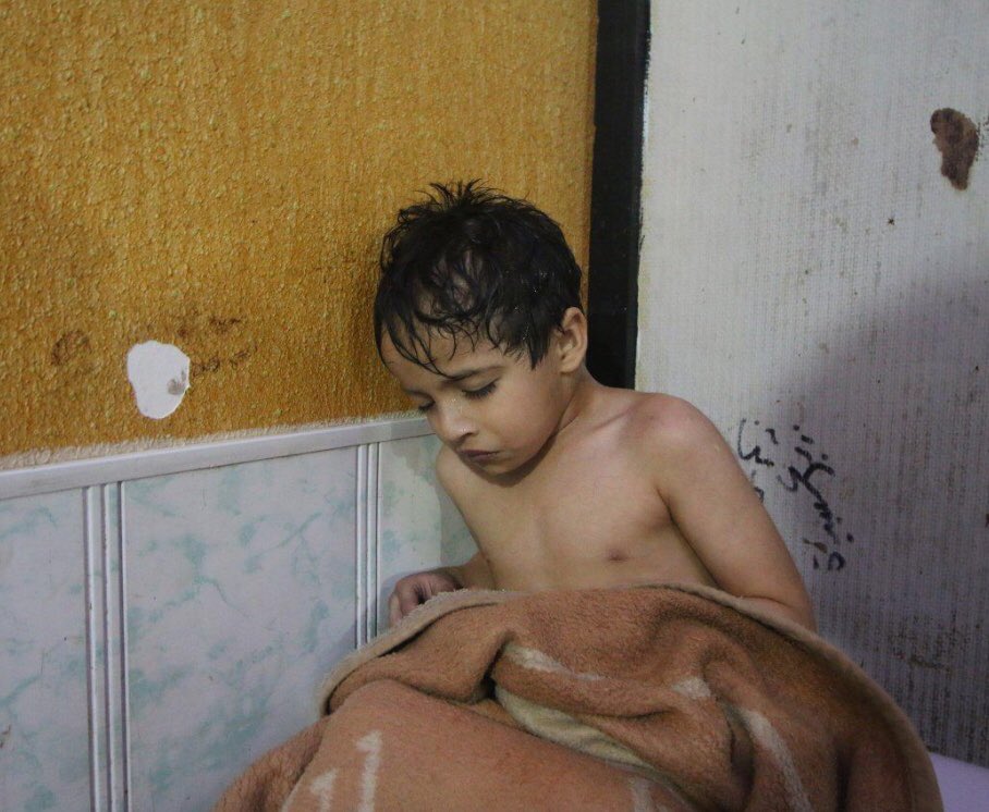 Acı kelimesi tarif edemez bu olup bitenleri!
Ey zalim dunya , bu cocuklar hangi sucun,hangi gunahin cezasini  çektiriyorsun?

#DoğuGuta
#DoğuGuta