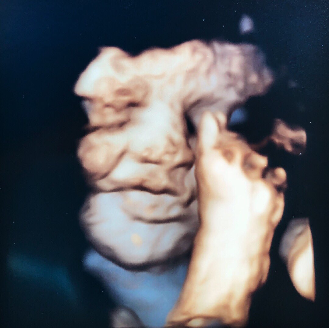 sheabeezy's tweet photo. We can’t wait to meet you sweet girl 💕 https://t.co/neTVTJQ3Iv