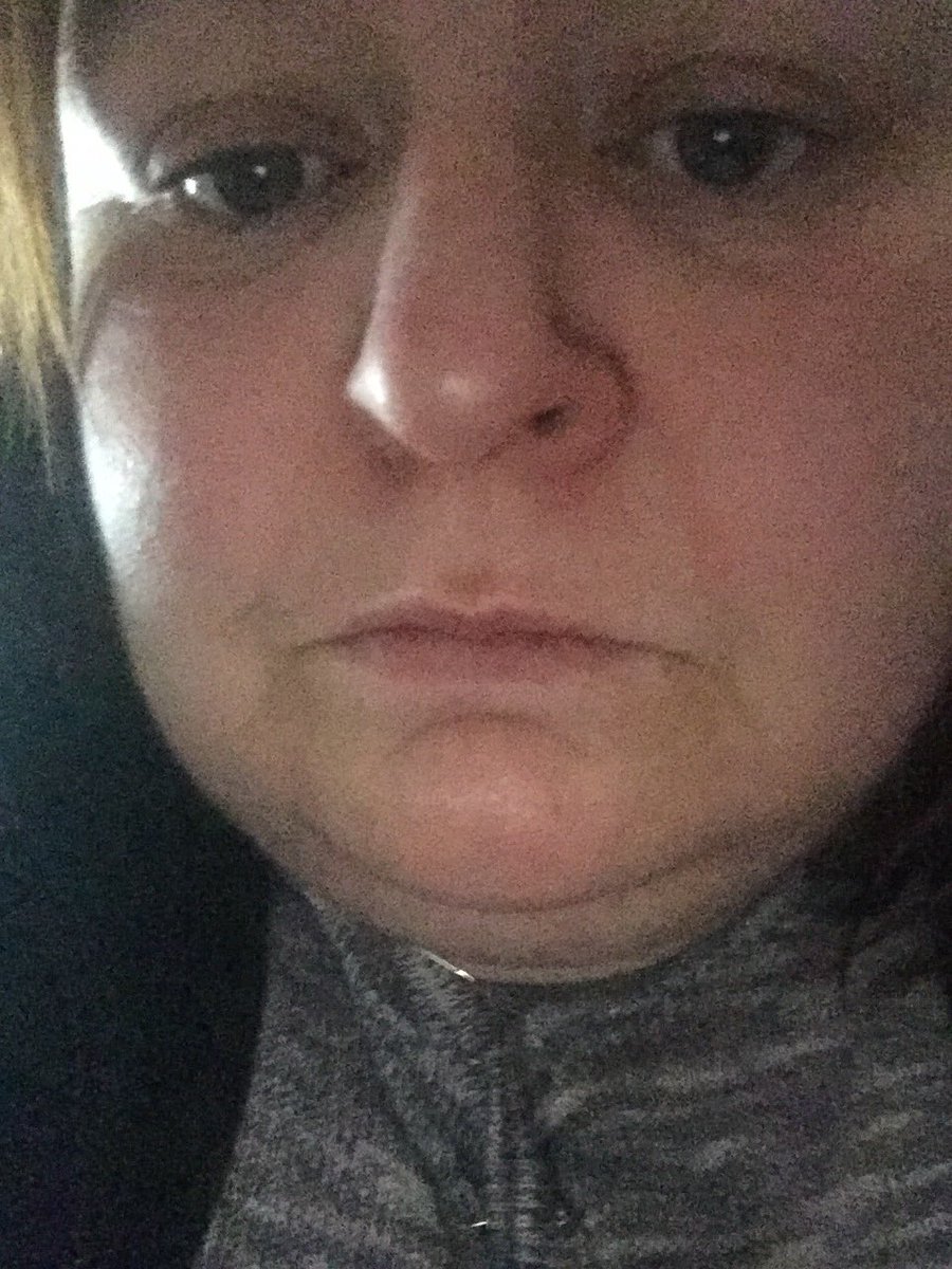 marybyr69663040's tweet image. #cushelle soft tissue no my nose is sore and fire red hate to see what my arse looks like lol