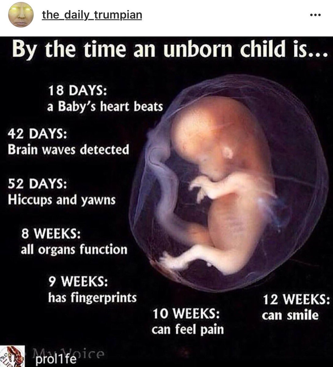 neesietweets's tweet photo. @StephenMilIer PLEASE think about this picture! This is an unborn baby 👶🏾👶🏼👶🏻👶👶🏽! #UnbornLivesMatter #DefundPP #MakeAdoptionYourOption 🤰🏻🤱🏼 https://t.co/79XYheBBtb