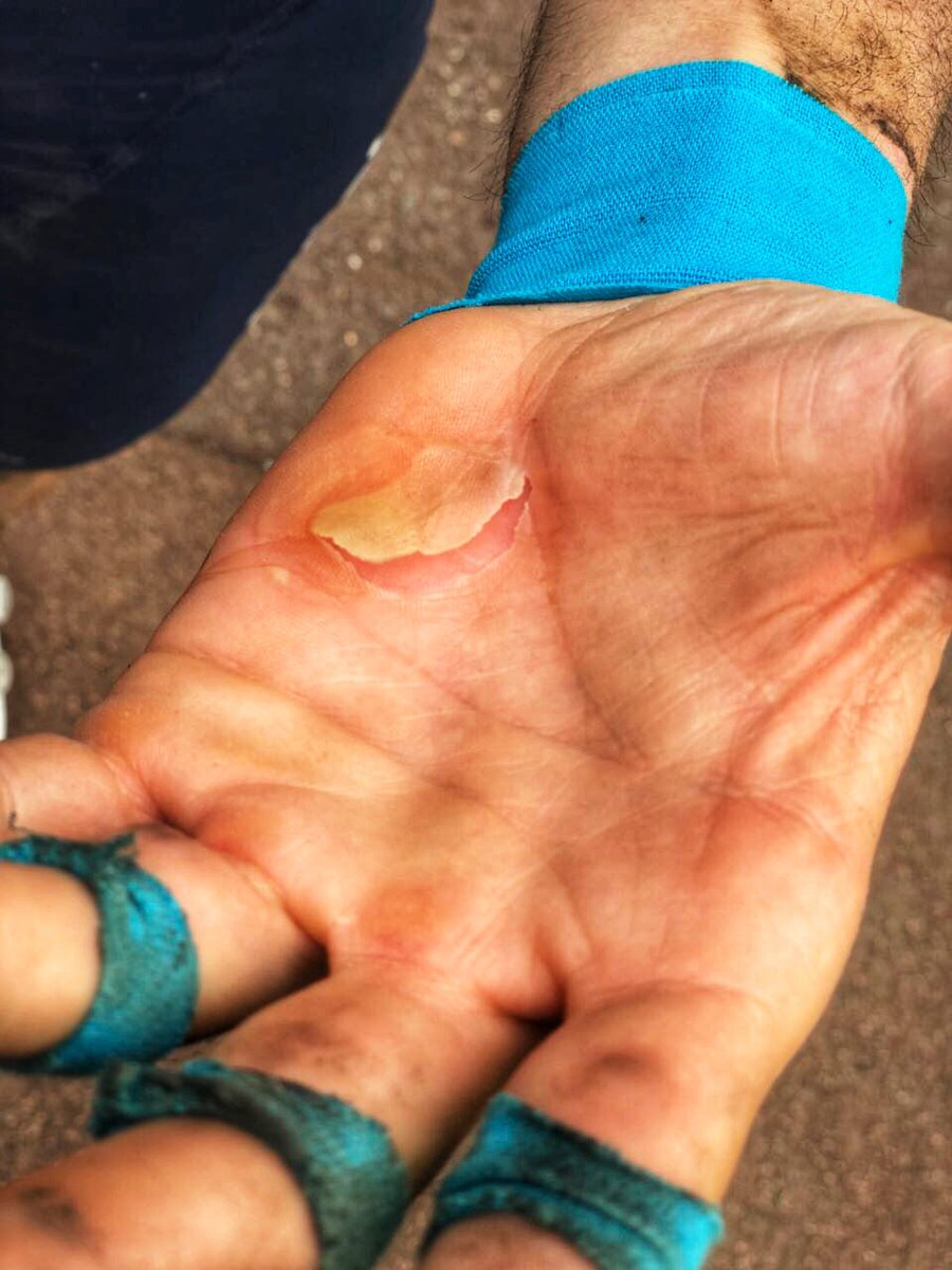 BarberoCbc's tweet photo. El infierno me abrasó las manos.
Que sensación !!!
En el km 200 imposible agarrar el manillar con seguridad en los tramos de pavé. https://t.co/26L8uiKN8t