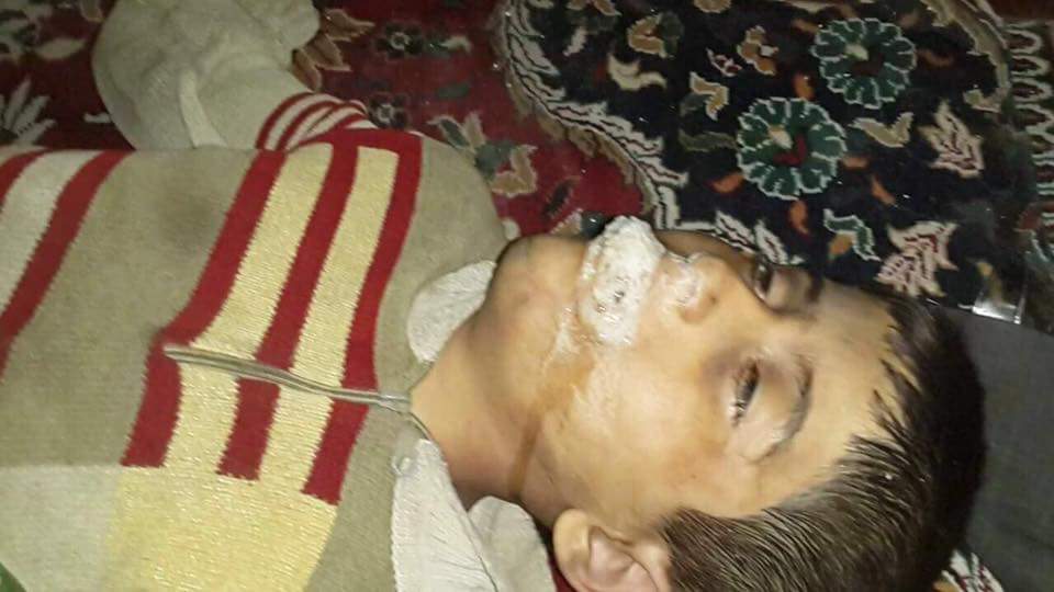 sangesnicola's tweet photo. Soffocati con il gas Sarin, oggi per loro nessuna indignazione, nessuna ipocrita bandierina nei profili. Intorno solo un vigliacco silenzio. Del resto i bambini morti in Siria non fanno audience. I figli di un Dio minore, non meritano le nostre lacrime!! https://t.co/pUdkKv3xo7
