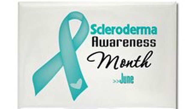 barbidh1's tweet photo. #sclerodermasucks https://t.co/NLHLdOgc9C