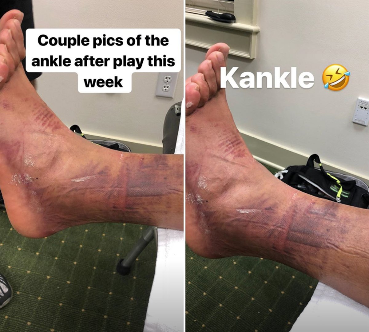 Give Tony Finau credit, he finished Top 10 in his first Masters with his ankle looking like *this*

(via <a href="/tonyfinaugolf/">Tony Finau Golf</a>)