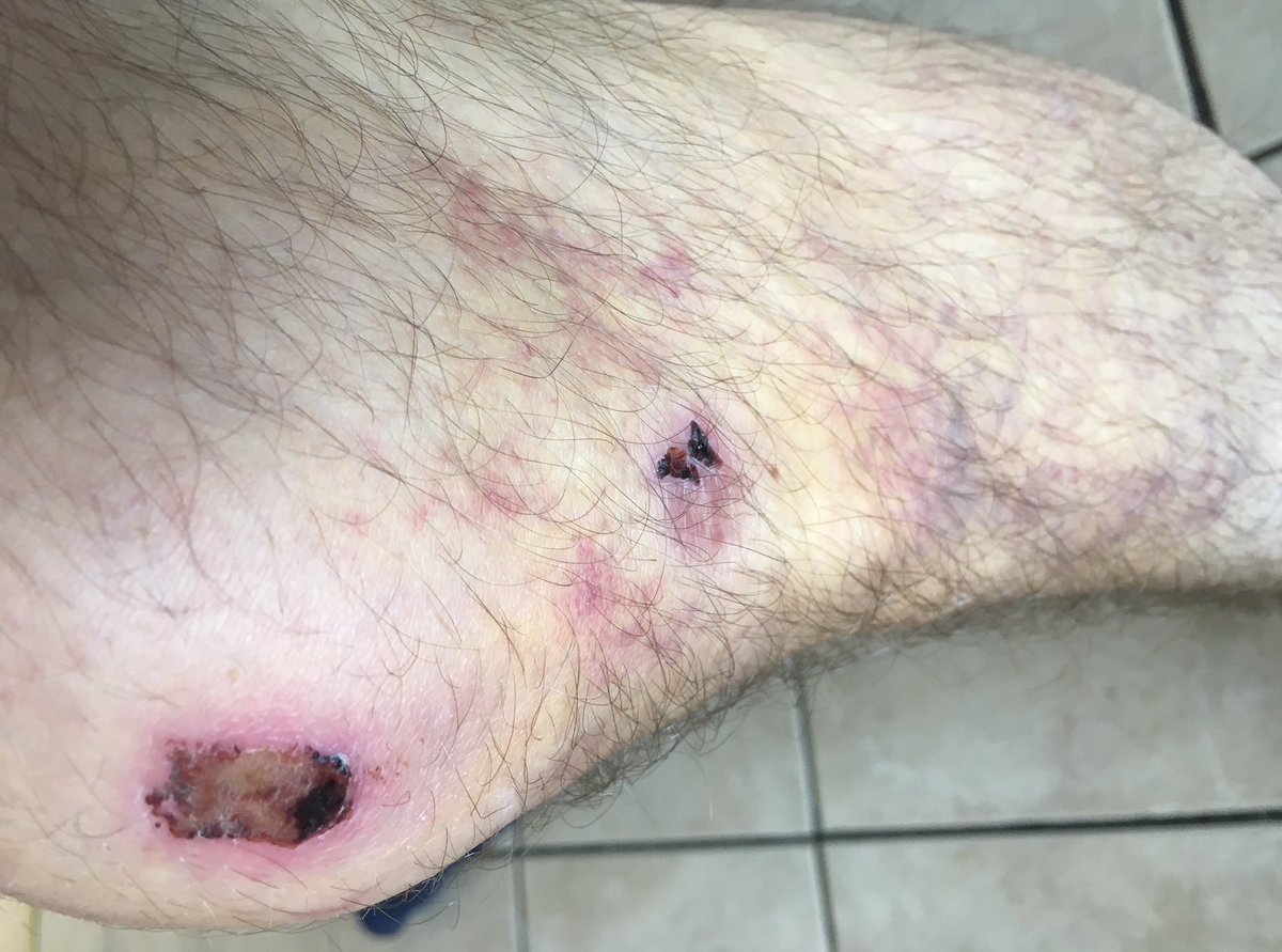 dcrills's tweet photo. Knee #knee https://t.co/MhBkbwwDtB