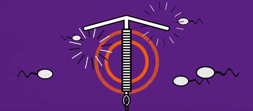 BrookCharity's tweet photo. We believe young people should have access to the full range of #contraceptive methods in order to choose what best suits their needs. If you're under 25 we'd love your input: https://t.co/2RQkrdZrTs #BrookHYS https://t.co/Kir0NQdPsL