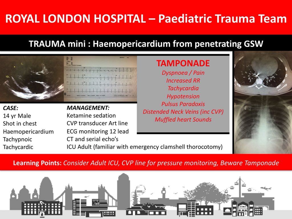 RLHPED's tweet photo. M&amp;M Learning points on penetrating chest trauma in kids #Anaesthetist #AandE #Anaesthesiology #Trauma #TraumaMini #paediatrics #FOAMed @bredabon @naomi_edmonds @RLHTraumaTREATS @ceri_elbourne @AnnielondonAA #learning #Education #KnifeCrimeEpidemic https://t.co/EJjQN3Xs9g