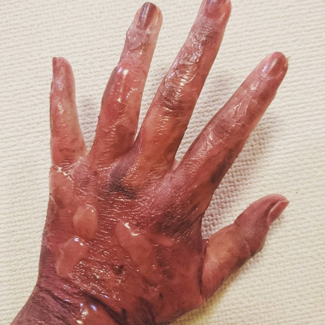 pinelu_make's tweet photo. 昨日忙しくて上げれなかった💦
火傷メイク🔥🔥
#特殊メイク #sfx #specialmake #makeup https://t.co/oa0sskvsQI
