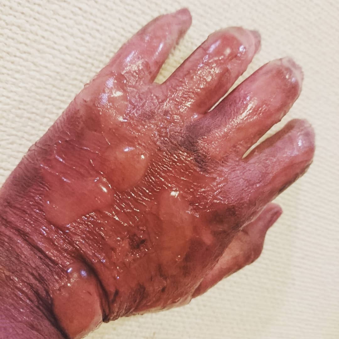 pinelu_make's tweet photo. 昨日忙しくて上げれなかった💦
火傷メイク🔥🔥
#特殊メイク #sfx #specialmake #makeup https://t.co/oa0sskvsQI