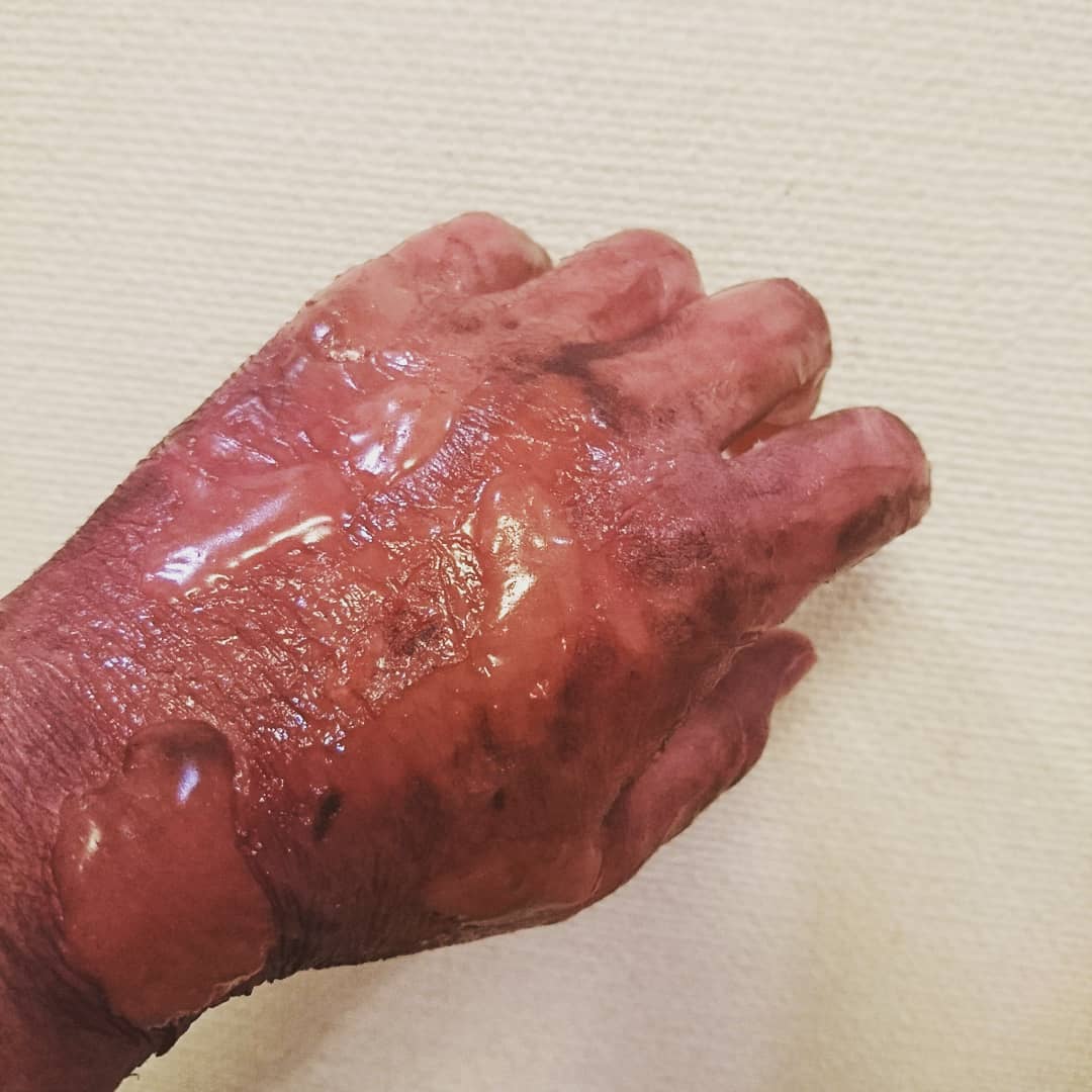 pinelu_make's tweet photo. 昨日忙しくて上げれなかった💦
火傷メイク🔥🔥
#特殊メイク #sfx #specialmake #makeup https://t.co/oa0sskvsQI