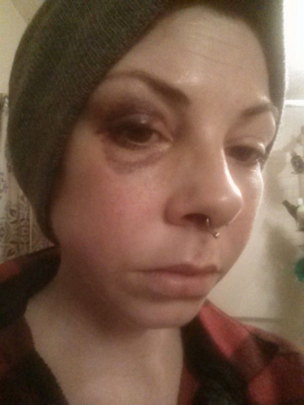 PopVoxxGeoff's tweet photo. Please help me help my friend Allie, who was viciously assaulted on the streets of her hometown. Details - https://t.co/UuoRigbA6R. Her GoFundMe - https://t.co/StTQvtibuj. https://t.co/jzmQls3563