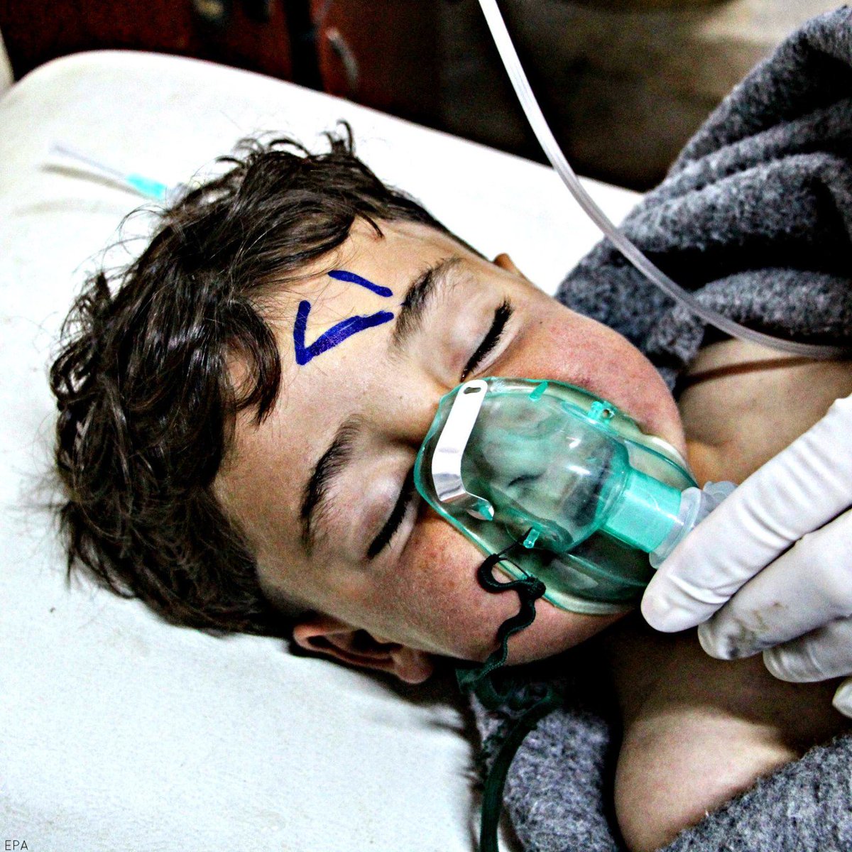UNHumanRights's tweet photo. #Douma: The intl community’s collective shrug in response to the use of one of the most ghastly weapons ever devised by man is incredibly dangerous. The use of chemical weapons is being normalized in #Syria: https://t.co/w2uo6bNimu https://t.co/D7WWtJYGpG