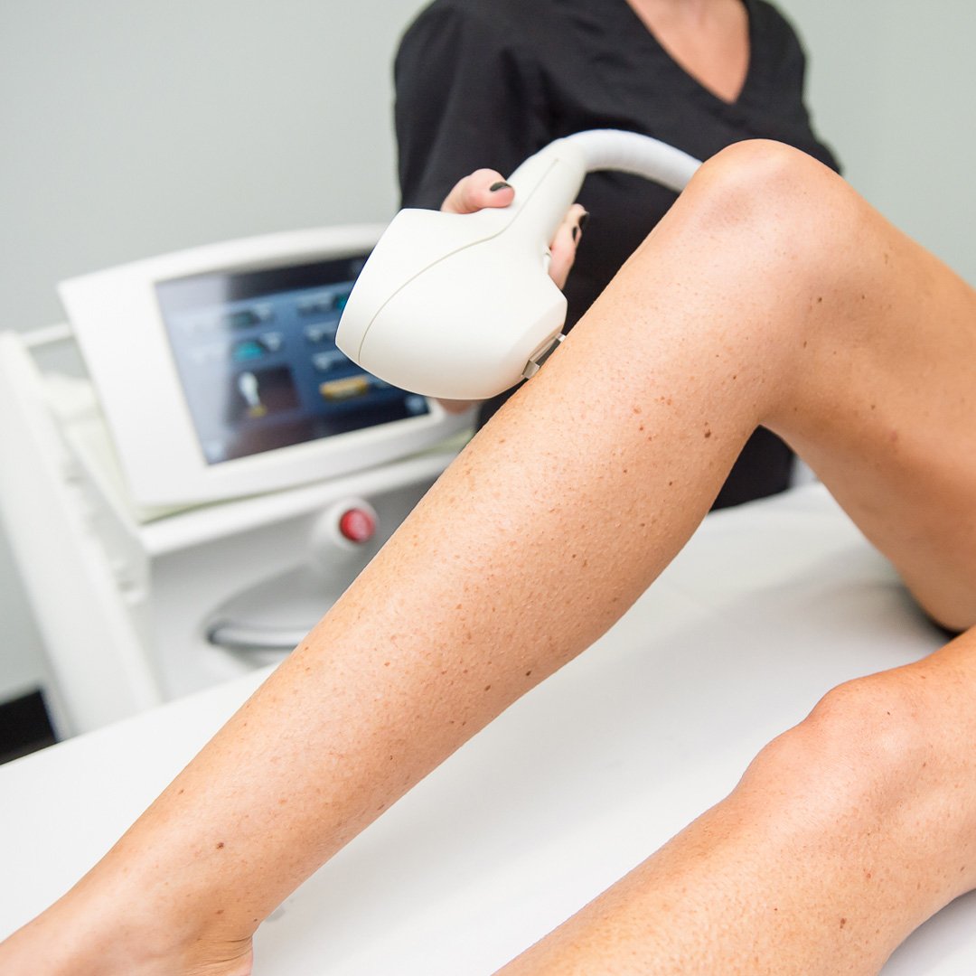 Venus_A_I's tweet photo. With summer just around the corner, #HairRemoval treatments are top of mind for consumers. Be one step ahead of your competitors with our state-of-the-art #IPL and #LaserHairRemoval devices: https://t.co/3XcK9bpJe5 #AestheticDevice #MedicalAesthetics #VenusConcept https://t.co/PCvYZ7Paoj
