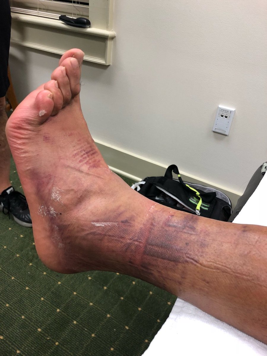 PGATOUR's tweet photo. Nothing was going to stop @tonyfinaugolf from playing last week. https://t.co/r5bucNx9KH
