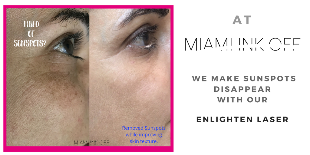 MiamiInkOff's tweet photo. Want to have clear and radiant skin? Enlighten your skin with our Pico Genesis and obtain optimal results in an average of 4 treatments! Schedule your free consultation today at https://t.co/81EfSof5Ow or call 📞 (305) 423-1515
#enlightenmiami #MIO #picogenesis #skinrejuvination https://t.co/u0NEmy8JYm