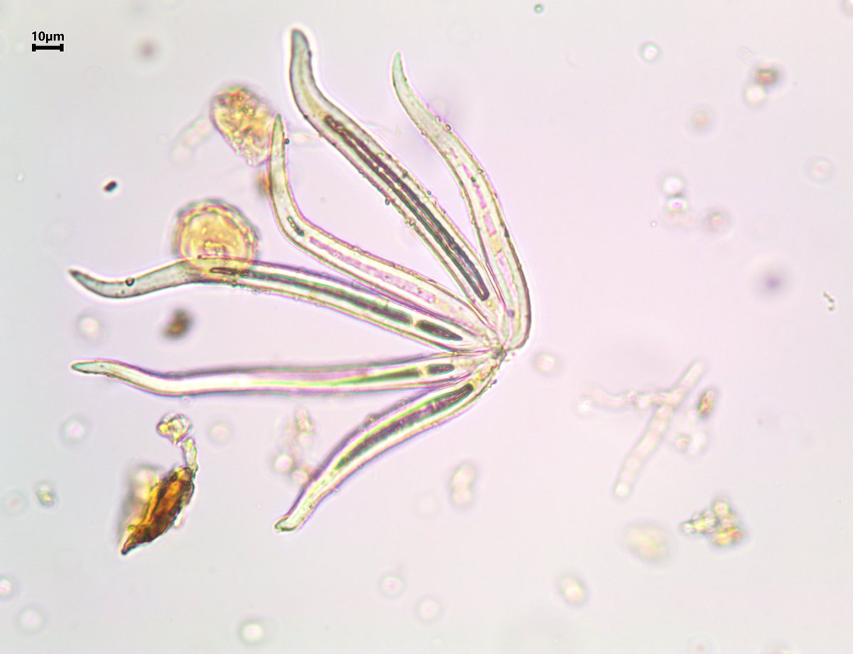 BalaChaudhary's tweet photo. Does anyone know what these are? #iMicro #crowdsourcingscience https://t.co/7SAHVMRTTL