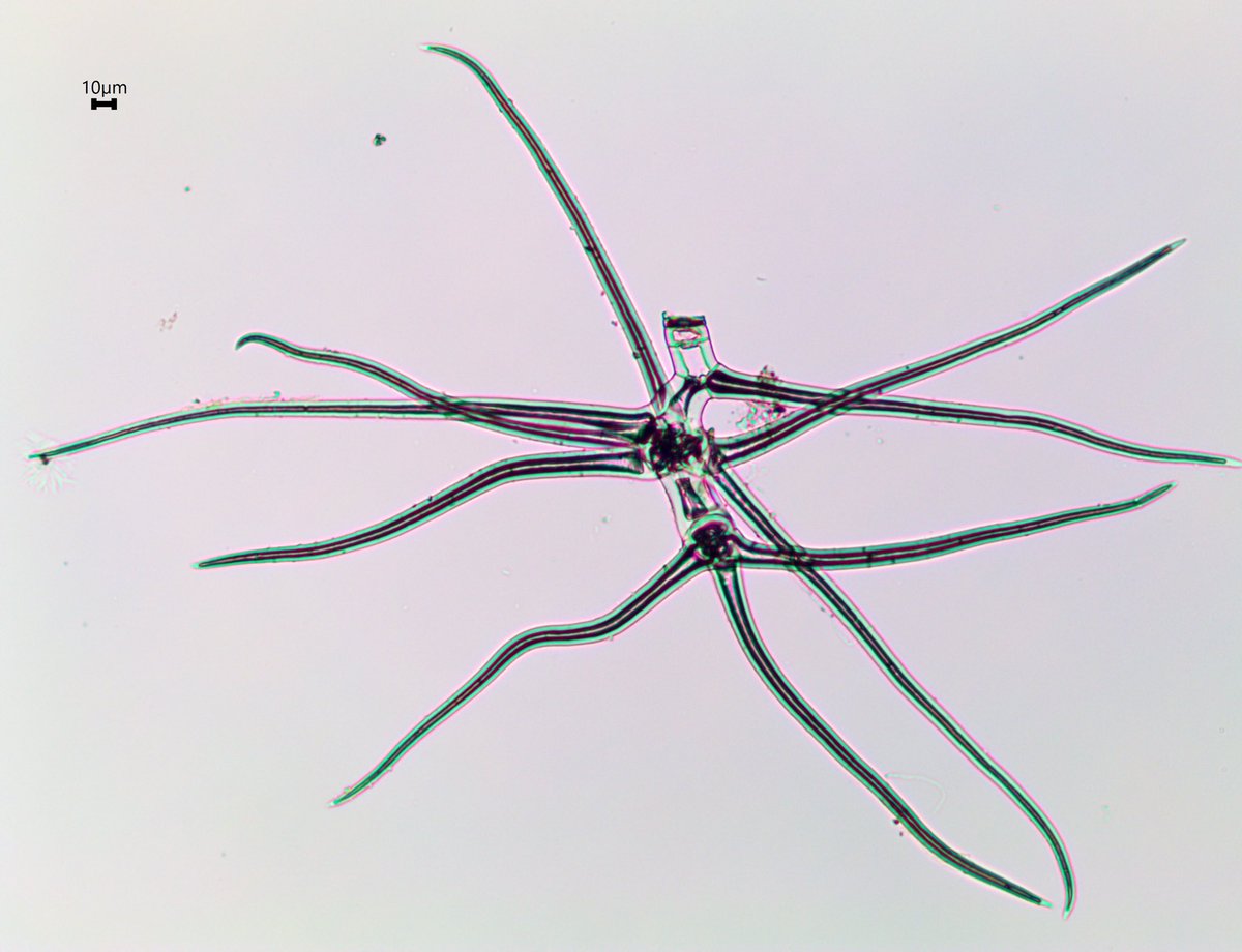 BalaChaudhary's tweet photo. Does anyone know what these are? #iMicro #crowdsourcingscience https://t.co/7SAHVMRTTL