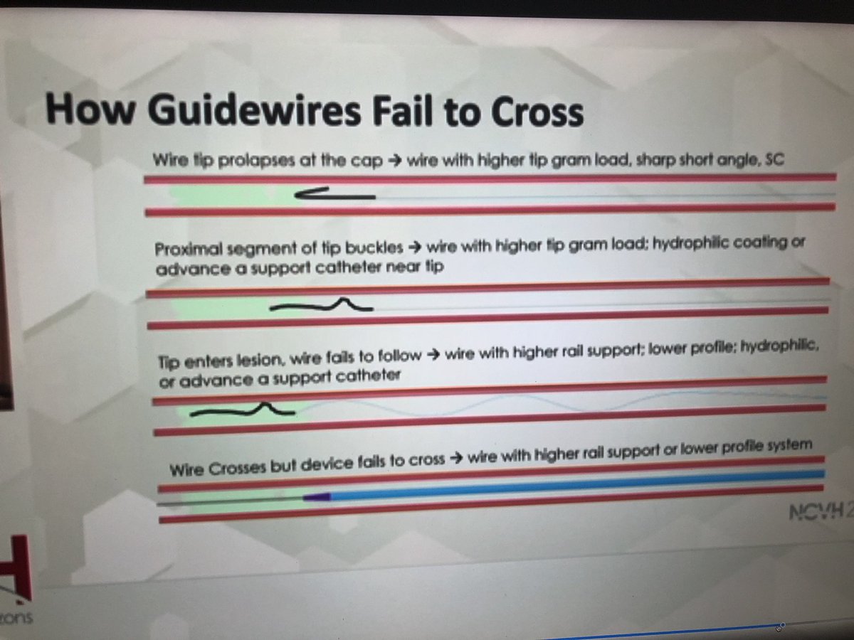 Nice review video on <a href="/VuMedi/">VuMedi</a> discussing pearls and pitfalls of #Guidewire selection.  Thanks Dr. Walker!
