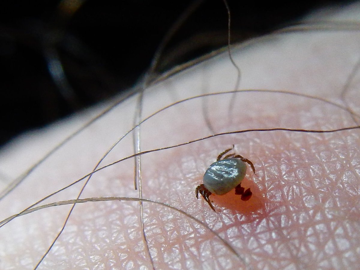 De ironische luxe van buiten wonen.
Een #teek "uit eigen tuin" op mijn bovenbeen.
Verraden door de inmiddels helaas bekende jeuk.
Vanaf nu dus ook controleren na het tuinieren.