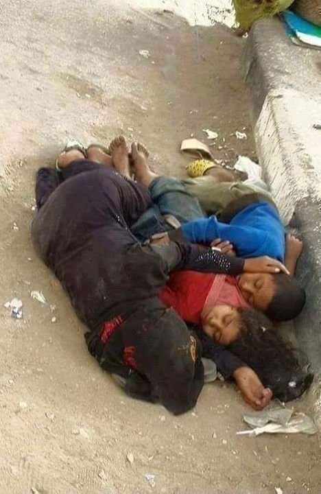 الحرمانالفقرالجوعمن اجل هذا نعمل حتى لا نرى مثل هذه الحالات البائسة