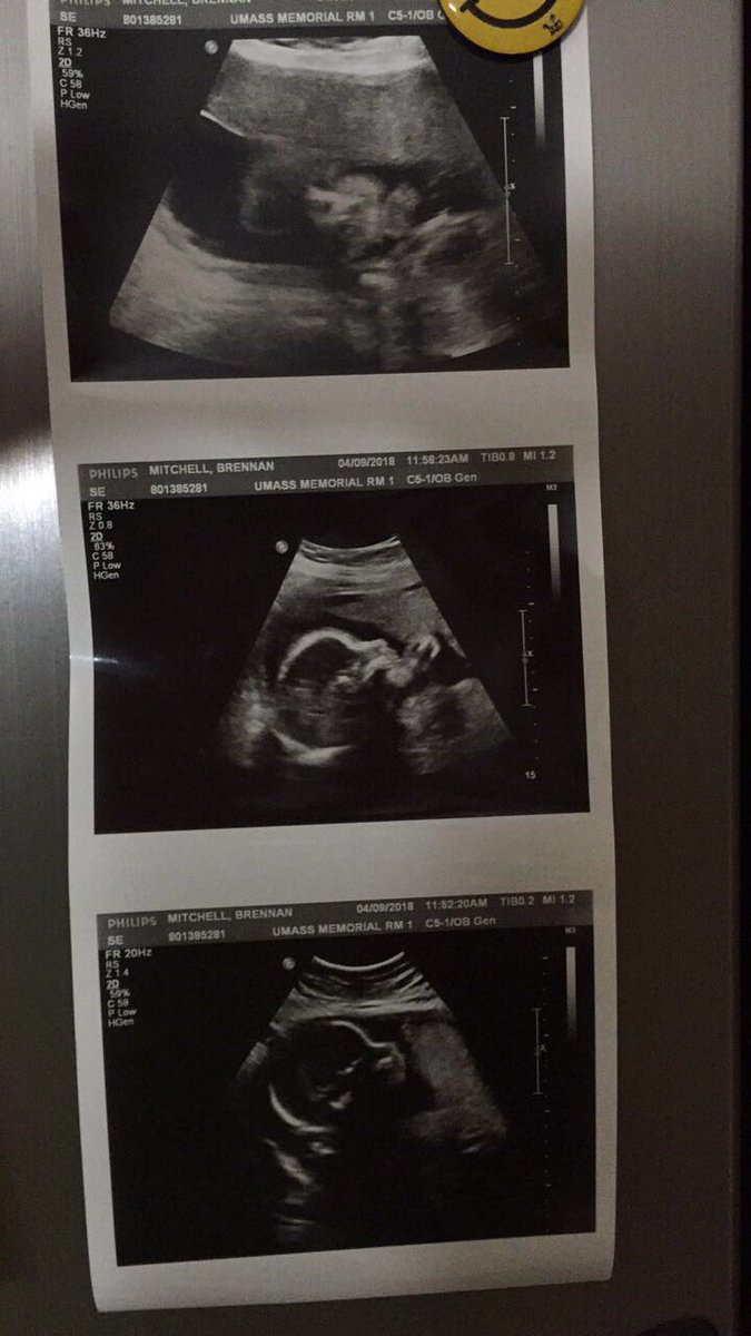ThatOneGuyy33's tweet photo. mommy and i can’t wait to meet you Faith Maria Rexrode. we love you to the moon and back! ❤️ @SassyVAGirl https://t.co/s7xZtk4Yq9