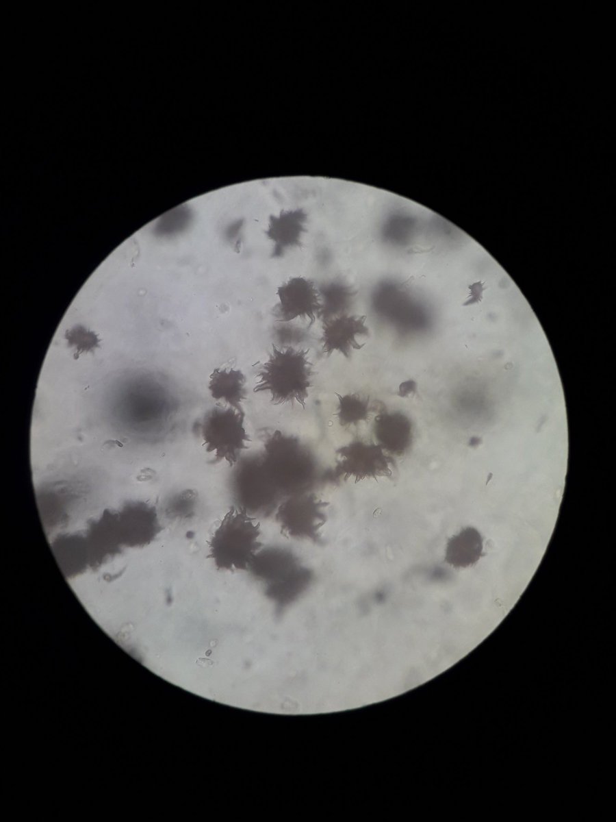 booyency's tweet image. Urine from a female px 🍏🍏🍏
#MedtechThing