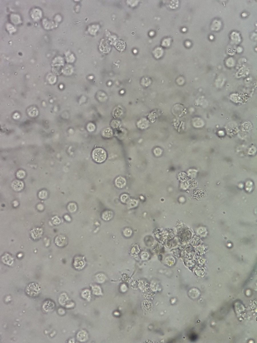 booyency's tweet image. Patient
Female/37
Spx: Stool (mucoid)
Initial dx: Infectious Diarrhea 
#MedtechThing