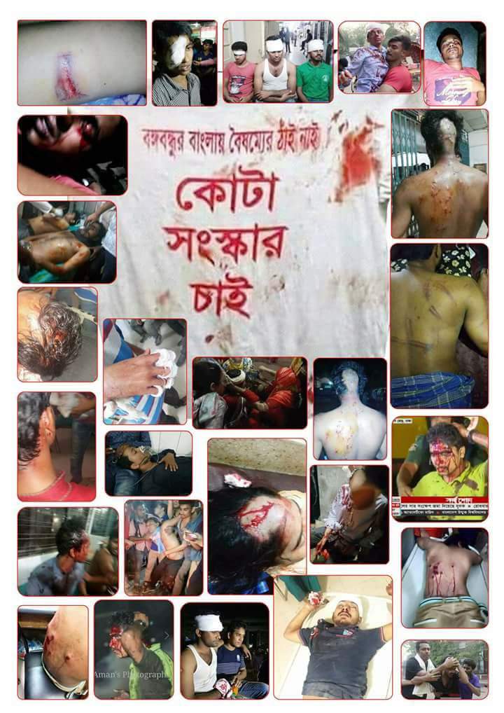 DcMushfiq's tweet photo. Save Bangladesh, save students. 
@BBC @BBCR1 @AlJazeera @CNN @cnni 
#QuotaReformProtest #QoutaReformBD #ReformQuotaBD #Bangladesh https://t.co/MwXzp8Iurf