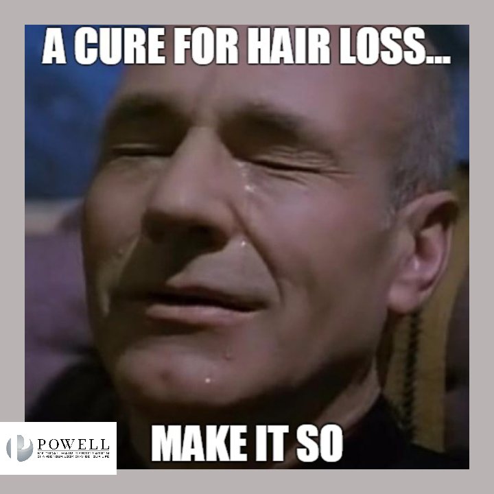 It's not so!! Until then, call us!858.546.0060
hairtransplantsandiego.com
#hairtransplantsandiego #beard #hairtransplant  #hairrestoration #fue #fut #hairloss #bald  #lasercap #prphair #hairtransplants #leucadia #sandiego #hillcrest #carlsbad #palmsprings #tijuana #elcentro #lgbt