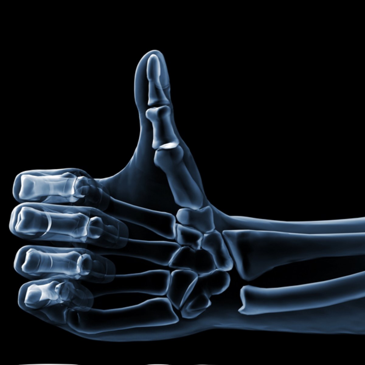 Home Care X Ray