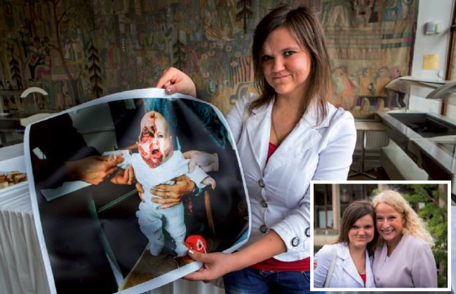 EllipseDK's tweet photo. This story started from a baby girl called Ira. An 8 months old baby that had a large hemangioma covering half of her face, including one eye. Read more on our Facebook page: https://t.co/jX3HneUicX
#NordlysbyEllipse #SWT #SelectiveWavebandTechnology #SubMillisecondPulses https://t.co/pwLm0o1nV9