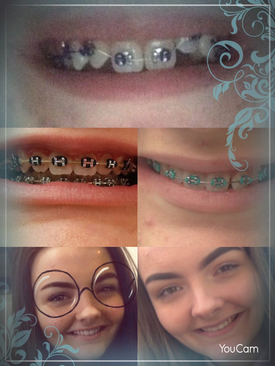A big thank you to all at <a href="/ClevelandOrtho/">ClevelandOrthodontic</a> for giving Lucy a perfect smile just like her twins😍