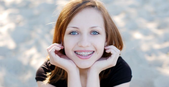 #DidYouKnow: #Braces are at work every moment of your #Orthodontic treatment. bit.ly/2Eb3615