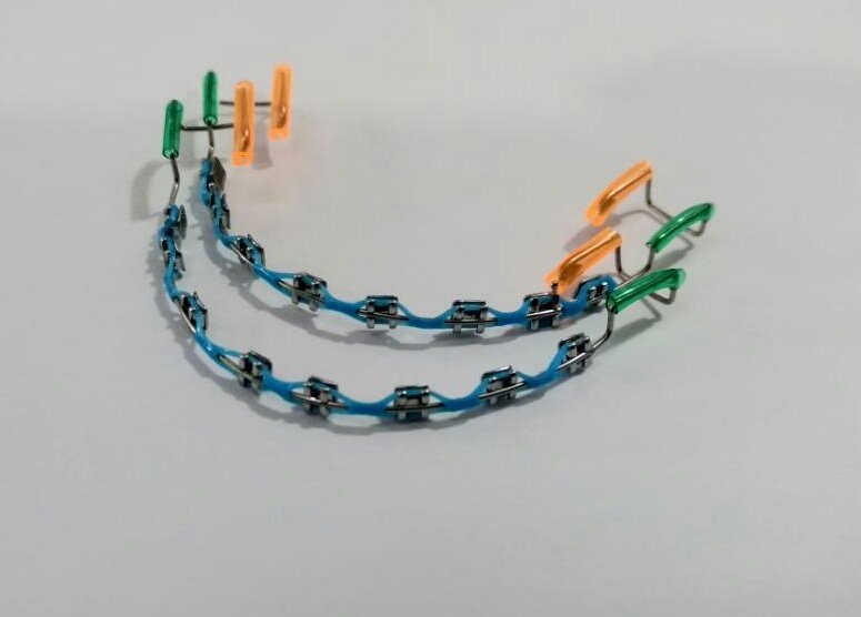 NerusCar's tweet photo. EVERNING ALL DEAR
Jom2.. Pelbagai pilihan warna  click braces.. Pilih2 k💁💁
📣📣Sila lihat video self fit pemasangan ClickBraces di wall sis
Ws 0196301357 

 #PasangSendiriJew
#Eksesori #TidakMengubhStrukturGigi #FreeBoxToday #ClickBraces  #ReadyStock #fakebraces #braces https://t.co/mW419C1man