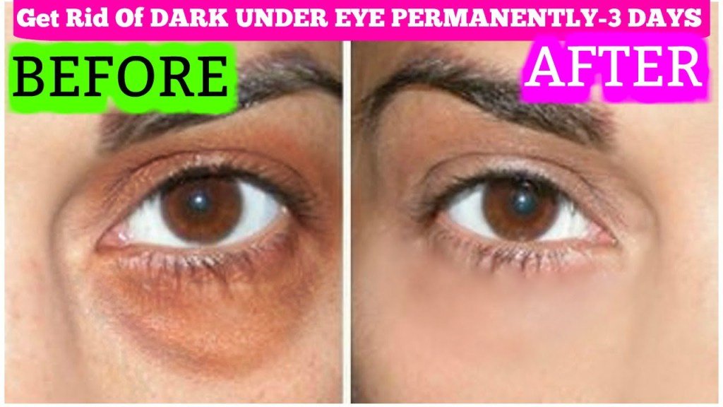 WorldHealthEdu's tweet photo. How To Get Rid Of Dark Circles – dark circles on your face https://t.co/9fqKK9ZAXp https://t.co/uFwK4NY2K2