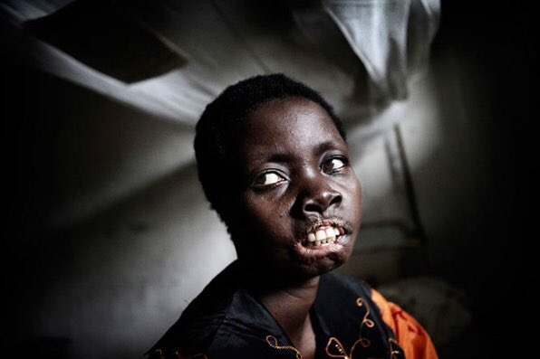IamYouIamNow's tweet photo. https://t.co/F0DYlUrZdA #DRC #RDCongo #sexualviolence #DRC #RDC #UN #Congo #Rwanda #SAVELIVES #Savelives #BasiYaKongo #IamYouIamNow #RwandaGenocide #silentgenocide #Congolese #congolaise https://t.co/WW1h7Eyw8b