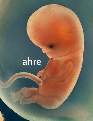 milanesariana's tweet photo. #AbortoLegalYa https://t.co/M1r4ImrPZP