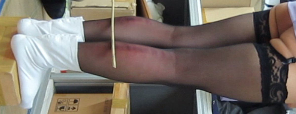 목침 회초리 종아리 (@ilsan_md) on Twitter photo 