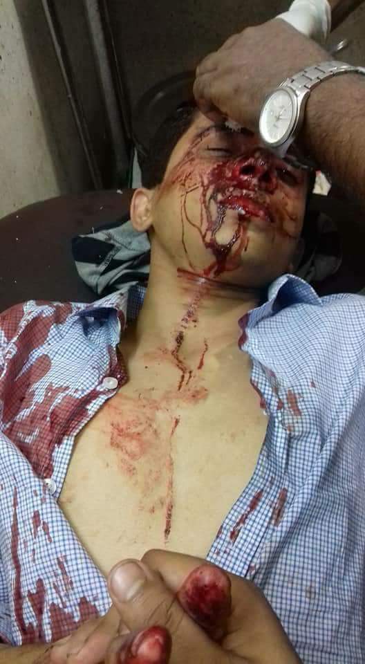 NahianTasnim8's tweet photo. #CNNInternational
#CNNAsia
#BBC
#Aljazeera
#ReformQuotaBD
Inhuman torture over students by police https://t.co/PhSnstQnLx