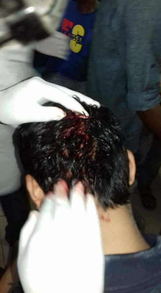 NahianTasnim8's tweet photo. #CNNInternational
#CNNAsia
#BBC
#Aljazeera
#ReformQuotaBD
Inhuman torture over students by police https://t.co/PhSnstQnLx