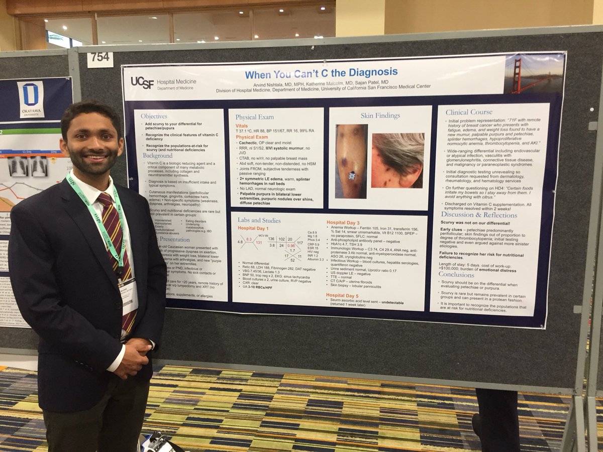Charlie M. Wray, DO, MS (@wraycharles) on Twitter photo Wait, scurvy still exists!? Great poster from <a href="/UCSF/">UC San Francisco</a>’s <a href="/arvindnishtala/">Arvind Nishtala</a> at #HospMed18. turns out the nutritionist made the diagnosis! Wait, scurvy still exists!? Great poster from <a href="/UCSF/">UC San Francisco</a>’s <a href="/arvindnishtala/">Arvind Nishtala</a> at #HospMed18. turns out the nutritionist made the diagnosis!