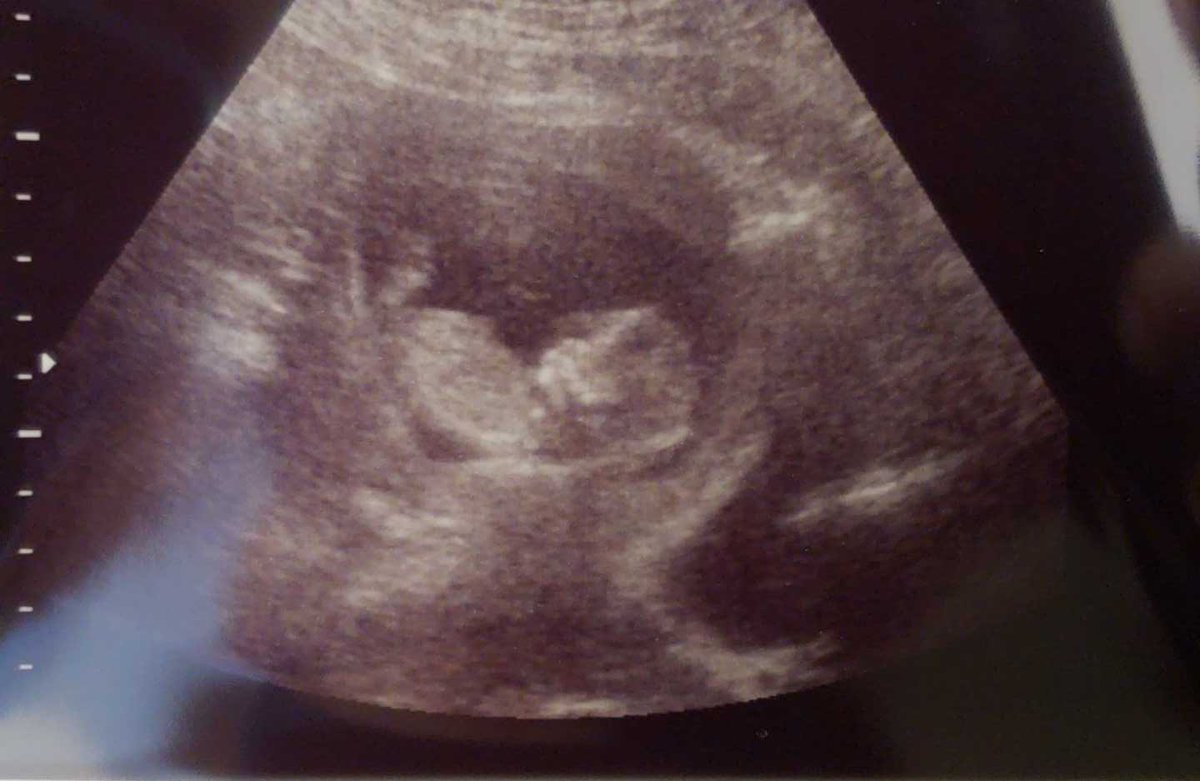 Baby Matlock. Due Date October 20th 2018. Gender unknown