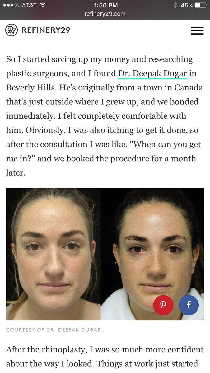 Scarless Nose™  Read Full <a href="/Refinery29/">Refinery29</a>  article here!!  refinery29.com/2018/04/195809…