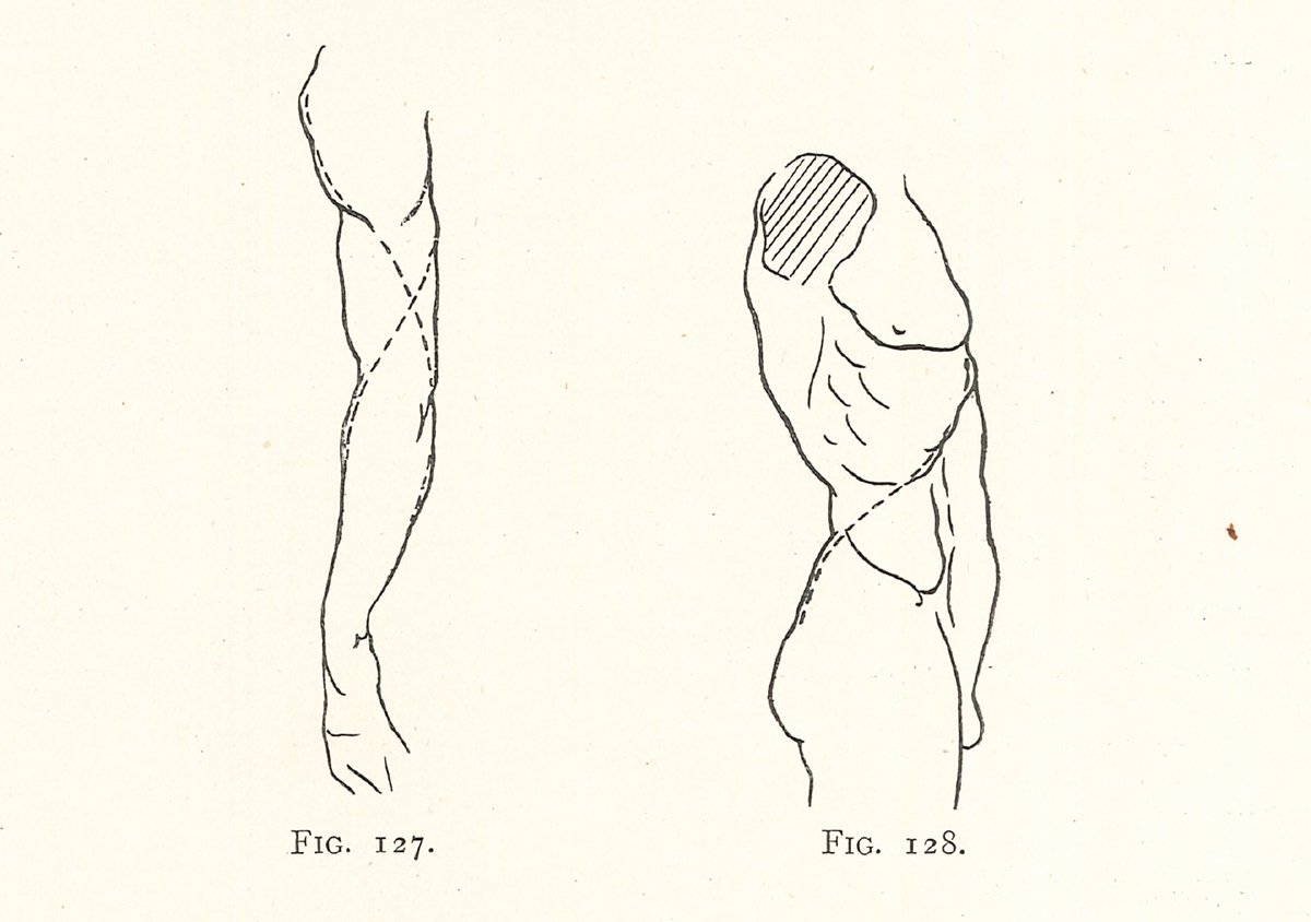 ランテリは、1901年に出版された自著の中で、体表に現れる溝をつなぎ、連続性のある曲線として捉える見方を説いた。この方法は、後年リシェも引用している。この方法は、それ以前の美術技法書の中にあったかもしれないが、美術解剖学書としては初出ではないか。 